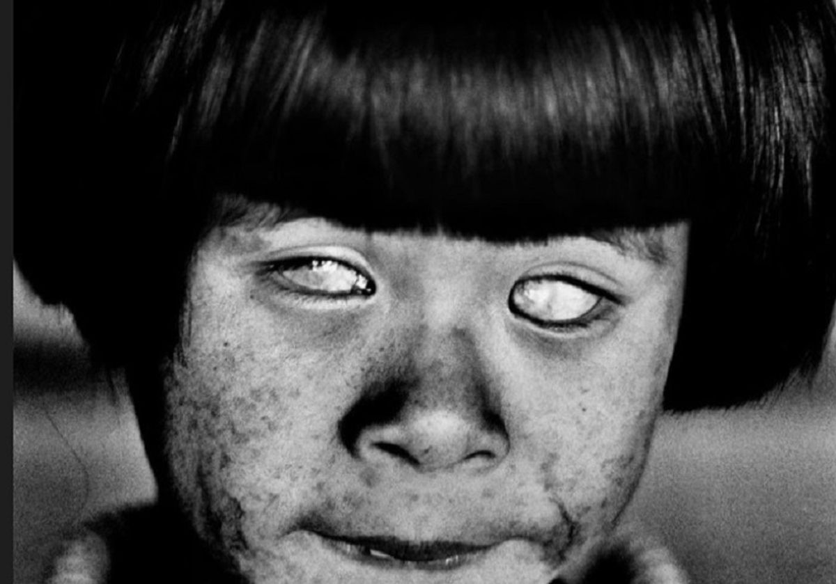 Blind girl in Hiroshima