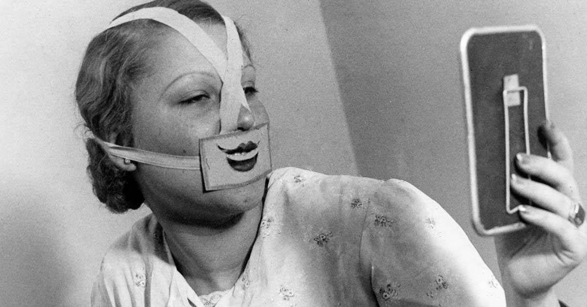 smile therapy 1930s