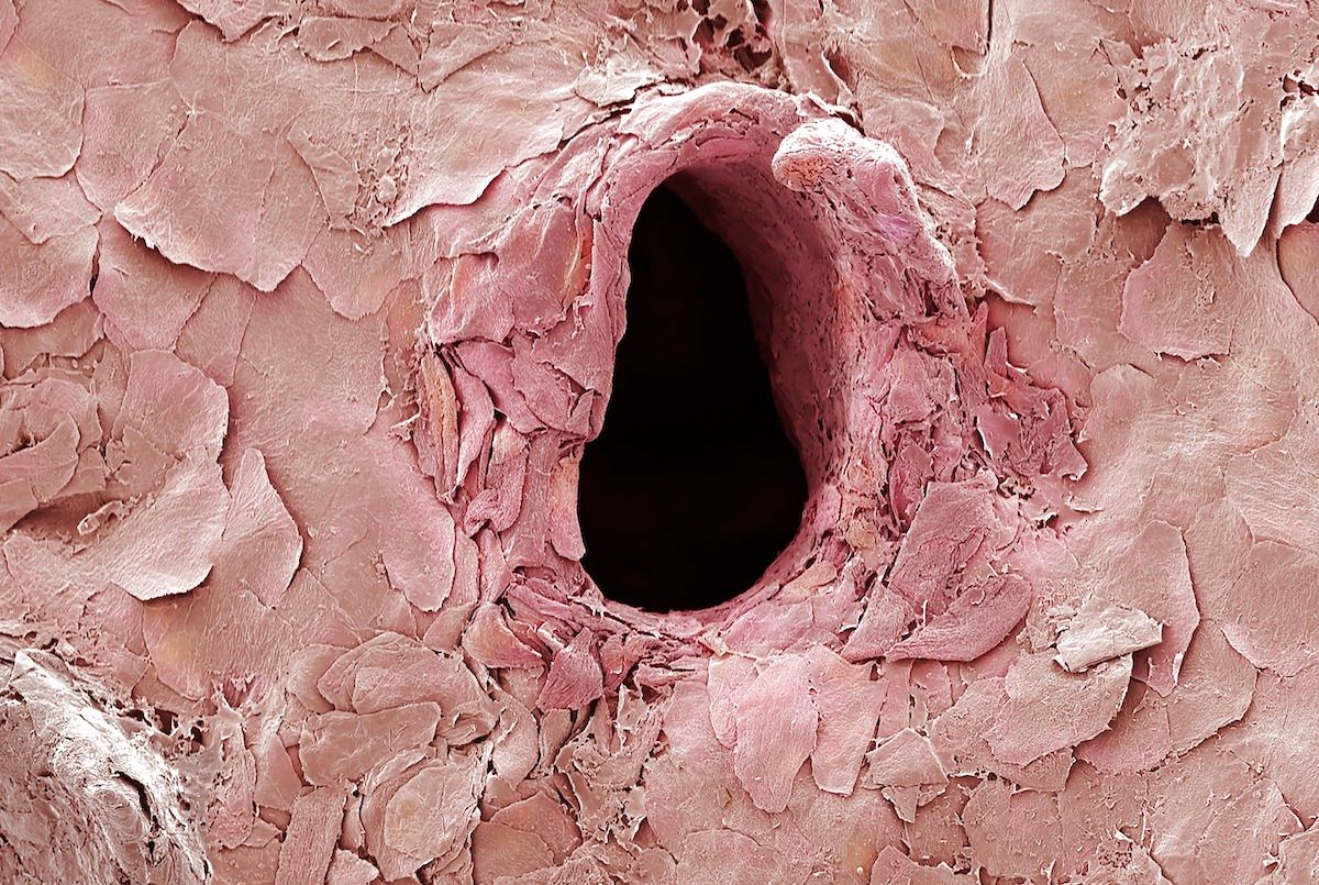 Hole