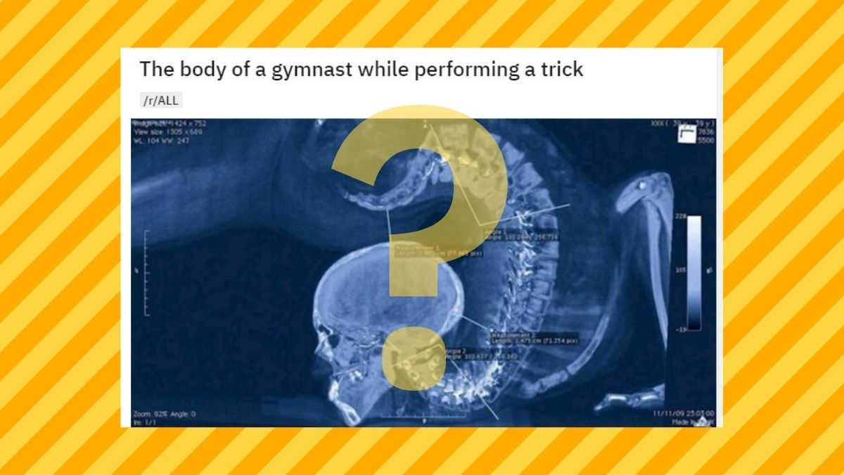Text, X-Ray, Medical Imaging X-Ray Film