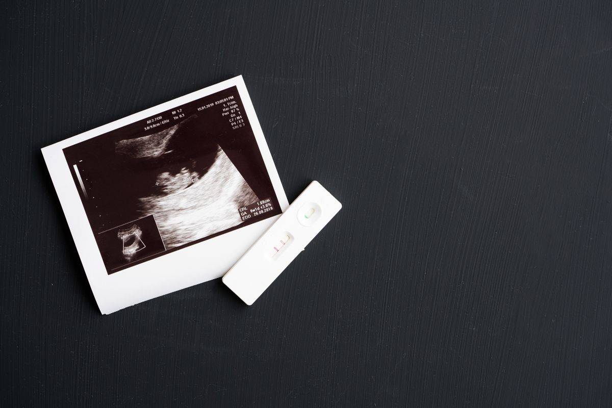 An image of an ultrasound of a fetus alongside a positive pregnancy test on a black background.