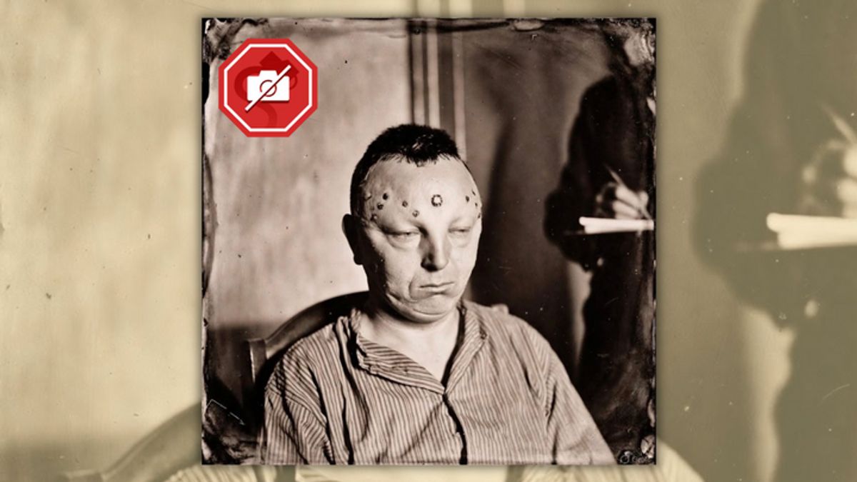 A fake, AI-generated sepia-toned image of a man with large circular scars on his forehead. 