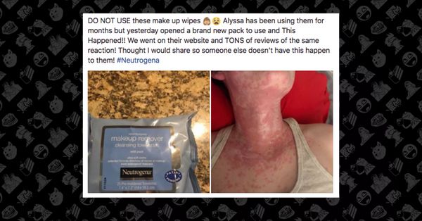 neutrogena wipes reaction