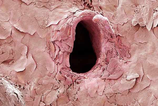 Hole