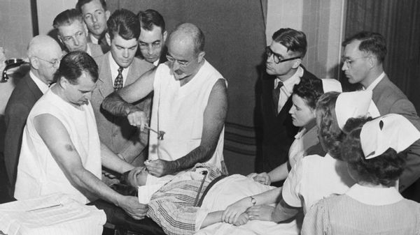 Dr. Walter Freeman performs a lobotomy using an instrument resembling an ice pick.