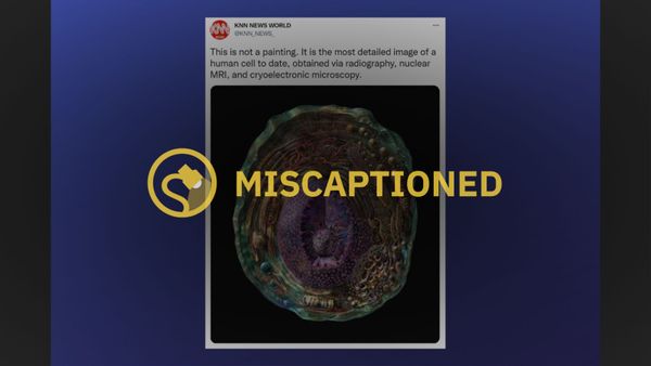Is this the most detail image of a human cell to date?