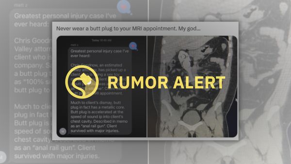A post that claims an MRI patient was seriously injured from wearing a butt plug during the procedure is labeled Rumor Alert.