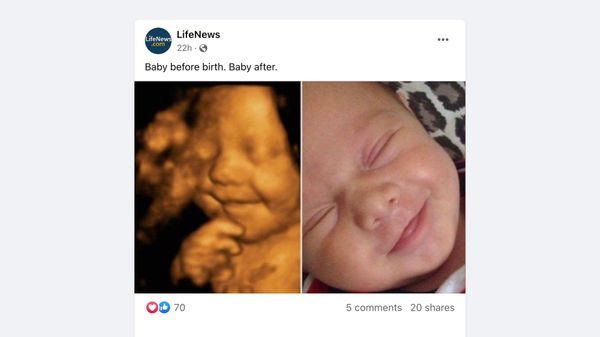 An image from LifeNews on Facebook purported to show a picture of a fetus smiling in his mother's womb before birth and the same baby smiling after being born.