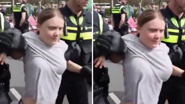 A white woman is held by people wearing black jackets. On the left side, her breasts are smaller, while on the right her breasts are larger.