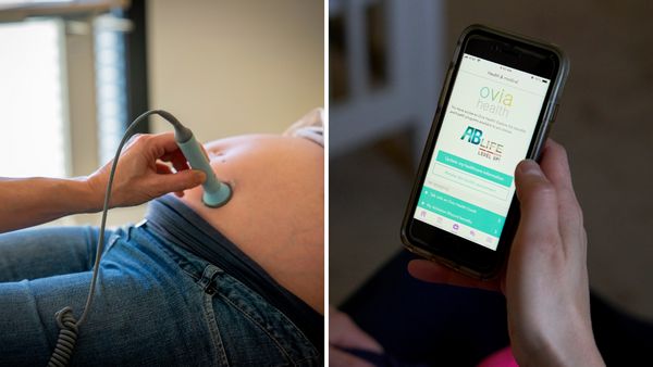Two images are shown next to each other. A medical instrument being used on a pregnant woman's belly is on the left, while the right shows the ovia app.